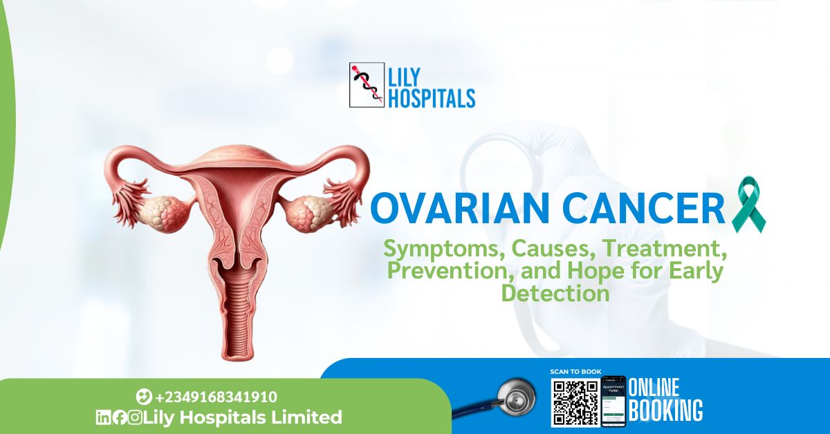 Ovarian Cancer: Symptoms, Causes, Treatment, Prevention, and Hope for Early Detection